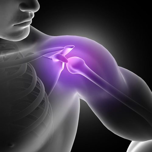 rotator-cuff-injury-1-1024x1024